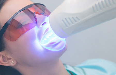 tratamiento de blanqueamiento dental en Córdoba